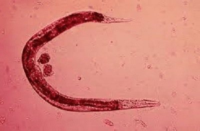 АЛЬВЕОКОККИ