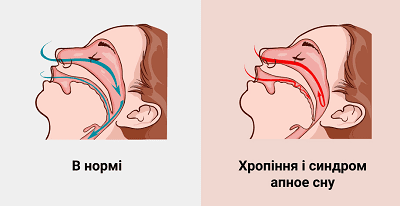 yak-vynykaye-xpopinnya
