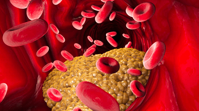 https://health4you.com.ua/wp-admin/post-new.php#:~:text=%D0%94%D0%95%D0%A2%D0%90%D0%9B%D0%98%20%D0%92%D0%9B%D0%9E%D0%96%D0%95%D0%9D%D0%98%D0%AF-,shho%2Dtake%2Dutvorennya%2Dtrombiv.,-png