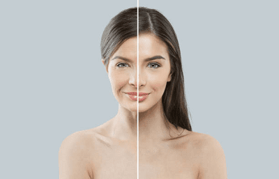 Як зберегти молодість.