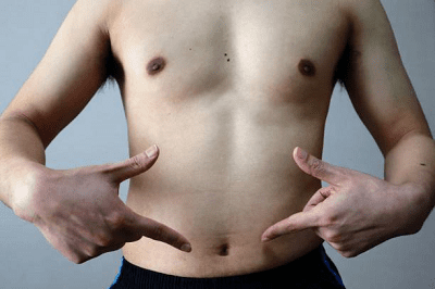 Чому жир відкладається саме на животі та боках